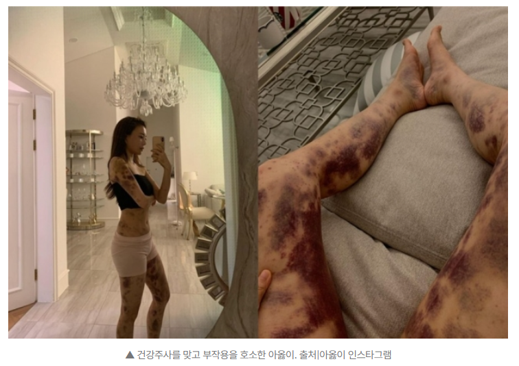 아옳이(김민영), 피부과 상대 13억 승소